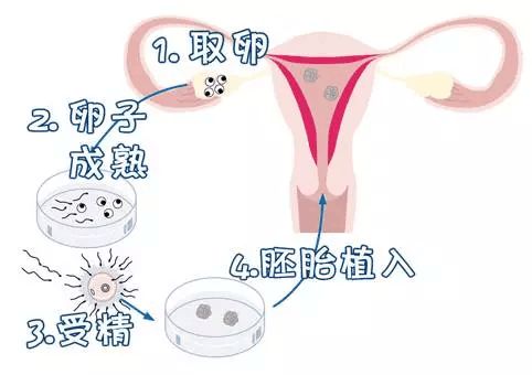 孕妇快生了勒肚子视频