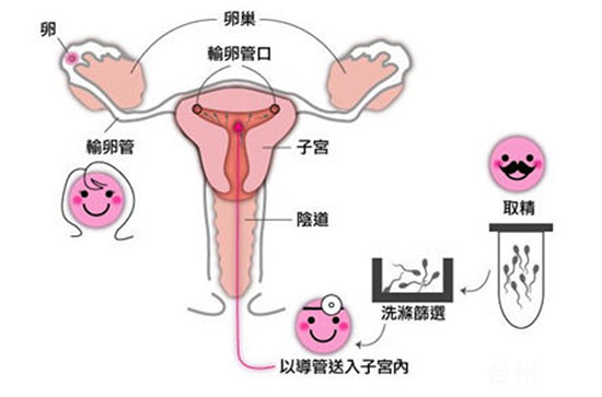 孕妇